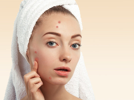 Does Red Light Therapy Help Acne?