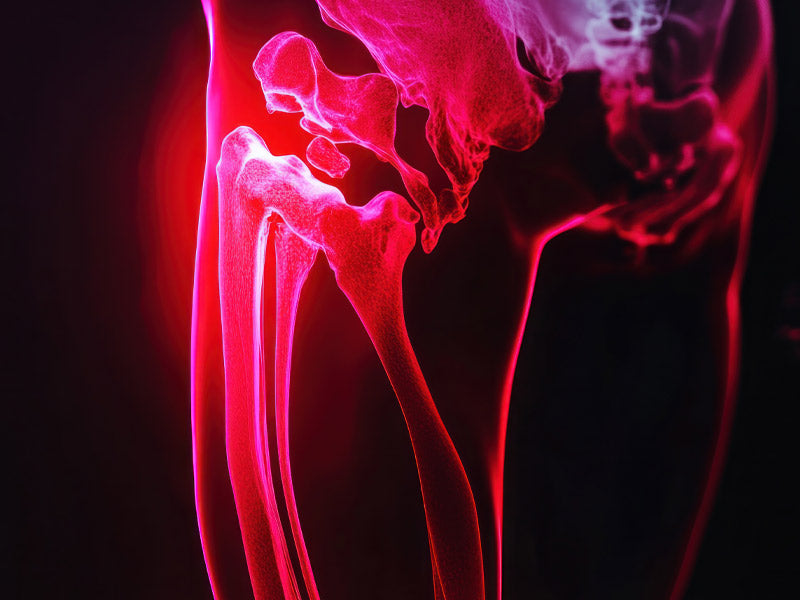 Red Light Therapy for Arthritis