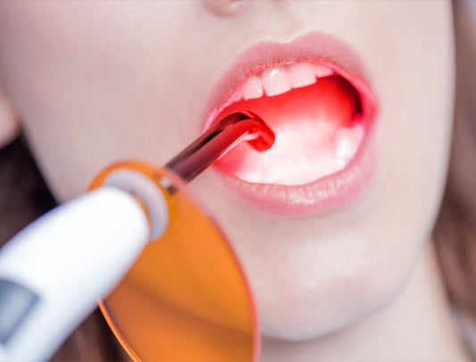 What You Need to Know About Red Light Therapy for Teeth